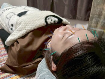 助ルポ鍼灸院