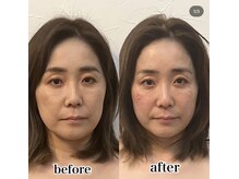 グレースフィオーレ モラージュ柏店(gracefiore)/【ヘッドスパ】ビフォーアフター