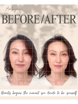 エイエービジュー(Aa.bijou)/