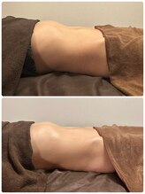 エミナル(EMINAL)/腸もみ　準備中［練馬］