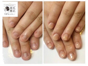 トイロ(toiro)の写真/憧れの縦長爪になりたい方のためのサロン《通えば通うほどにキレイな指先へ》爪悩みにあわせた施術をご提案