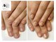 トイロ(toiro)の写真/憧れの縦長爪になりたい方のためのサロン《通えば通うほどにキレイな指先へ》爪悩みにあわせた施術をご提案