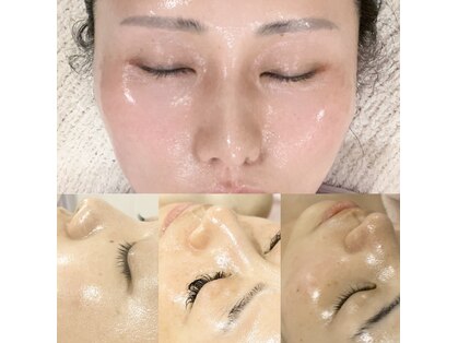 ミニョンボーテ(mignon beaute)の写真