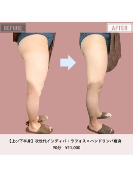 マーリエ(Malie)/【ラフォス】脚