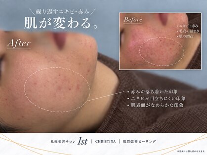 ファースト(1st)の写真