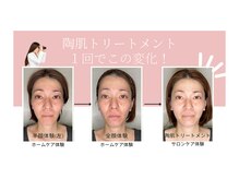 シトリン(Citrine)/《REVI》ハーブピーリング