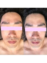 ビクト(Vict)/オプション人気NO.1