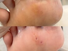 キラネイル アンド アイラッシュ by World Beauty(KIRA)/フットケア