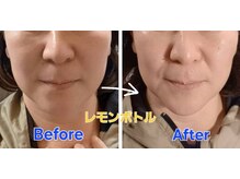 アン 銀座(ann)/レモンボトル