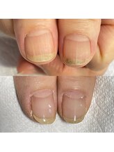 シュシュ(shou shou)/自爪育成