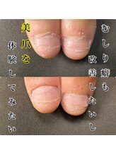 ヴィヴィアナ(VIVIANA)/私の爪でも大丈夫？
