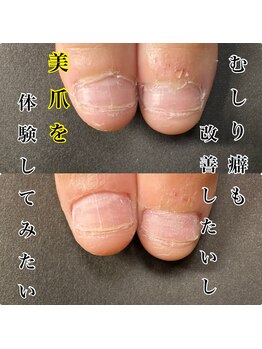 ヴィヴィアナ(VIVIANA)/私の爪でも大丈夫?