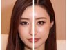 【美容鍼】【小顔】オリジナルHaRi&小顔施術(75分)14,400円→5,980円