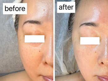 マハロ(Mahalo.N)/オーダーフェイシャル【乾燥】