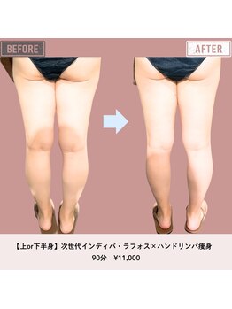 マーリエ(Malie)/【ラフォス】脚～ヒップ