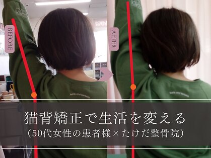 たけだ整骨院 月寒中央の写真