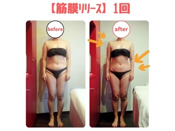 ビューティサロン キヨの部屋(beauty salon)/【筋膜リリース】　１回