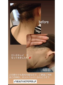 ホクラニ(Hokulani)/アップもきれいに♪