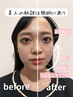 9/2(月)限定【小顔矯正+美容整体】小顔と美姿勢が叶う¥3980/90分（検査込み)
