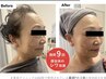 【お肌の悩みを根本から改善】シミ、シワ、たるみ、ニキビ、美白。結果重視!
