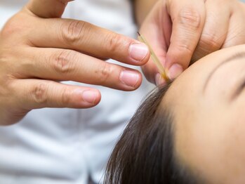 ゆずりは鍼灸整骨院の写真/当院自慢のメニューを組み合わせた施術が大高評★毎日がんばるあなたの”眼精疲労”を解消します♪