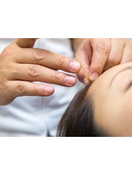 眼精疲労を解消したい