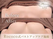 ロココ 水戸店(Rococo)/BEFORE/AFTER