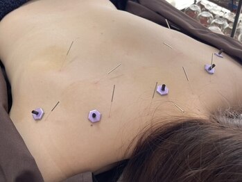 ハリトト鍼灸院の写真/国家資格者が施術！オーダーメイド鍼灸×本格整体で長年の首肩コリ・腰痛を改善◎施術後の体の軽さを実感！