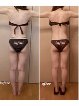 アンフィニ(infini)/短期集中コース全身6回（2ヶ月）