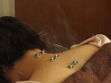 健康堂 道玄坂院/鍼とお灸の組み合わせも！