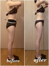 アンフィニ(infini)/ブライダルコース5回(2ヶ月）