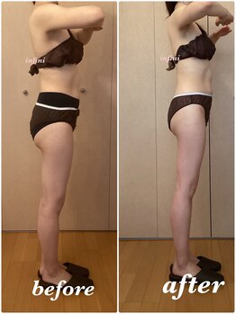 アンフィニ(infini)/ブライダルコース5回(2ヶ月)