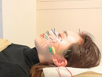 アム(aM)の写真/【薬院大通駅徒歩3分】美容鍼で、内側からリフトアップ。お悩みを解消していきます。初めての方でも◎