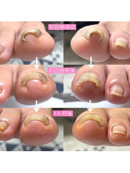 補正後すぐに変化を感じれる