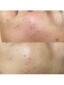 ジュエッテ(jouete)/シーナジーピール