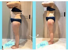 千歳の女神 西尾本店/【施術風景】Before/After