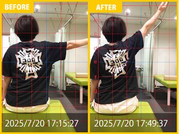 整体院 元 くまなん店/腰痛の悩み