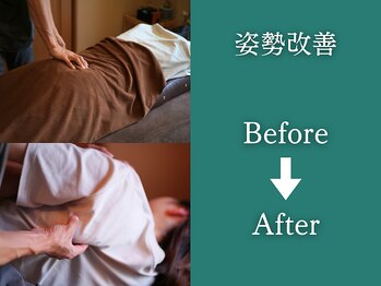 カケル(KAKERU)/姿勢改善　ビフォーアフター