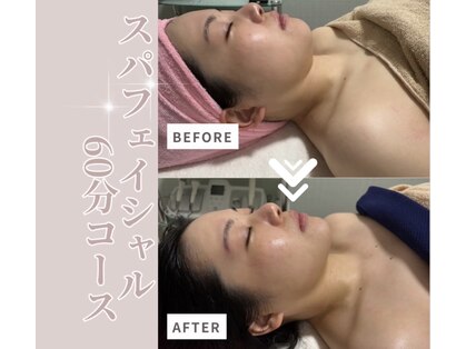 エクラン バイ ルシア(ekuRan by Rucia)の写真