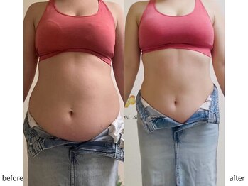 ヨサパーク 新百合ヶ丘店(YOSA PARK)/【before&after】