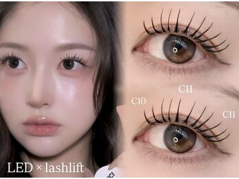 恵比寿ミリ(mm)/