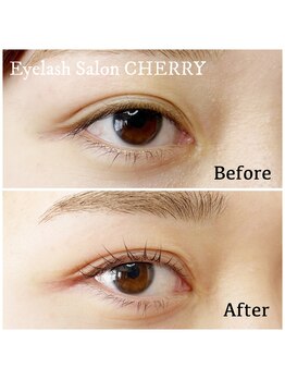 チェリー(CHERRY)/ラッシュリフト