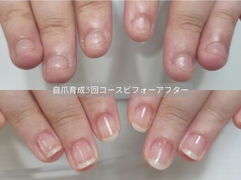 ミンスネイル(Mins Nail)