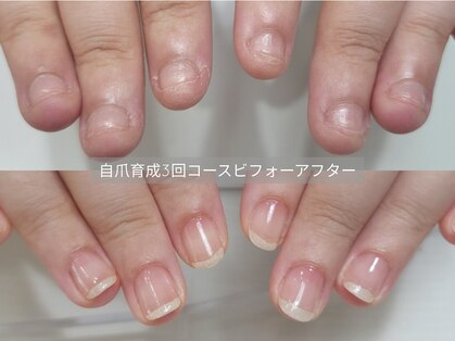 ミンスネイル(Mins Nail)の写真