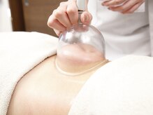 ソフィーム/カップ吸