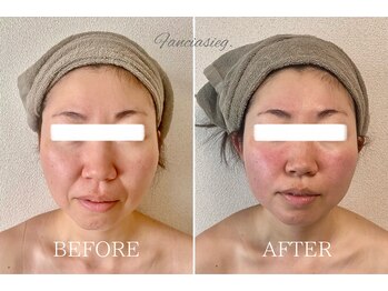 ファンシアジーク(Fanciasieg.)/韓国式美顔コルギ