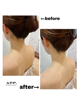 アプ(APP.)/うなじ（襟足）before→after