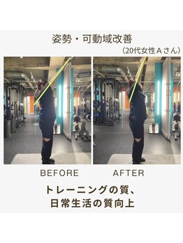 ミル(MILL)/【ビフォーアフター】姿勢改善