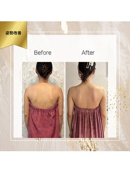 ロココ 町田店(Rococo)/肩のライン!キレイな肩甲骨に!