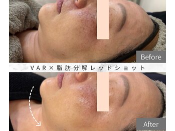 ルームエイトエイティスリー 新宿(R883)/VAR×レッドショット 最強引締め